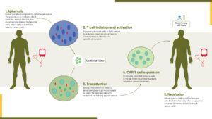 CAR-T Cell Therapy Procedure - Cytecare
