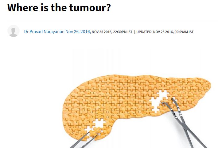 Where is the Tumour - Pancreatic Cancer