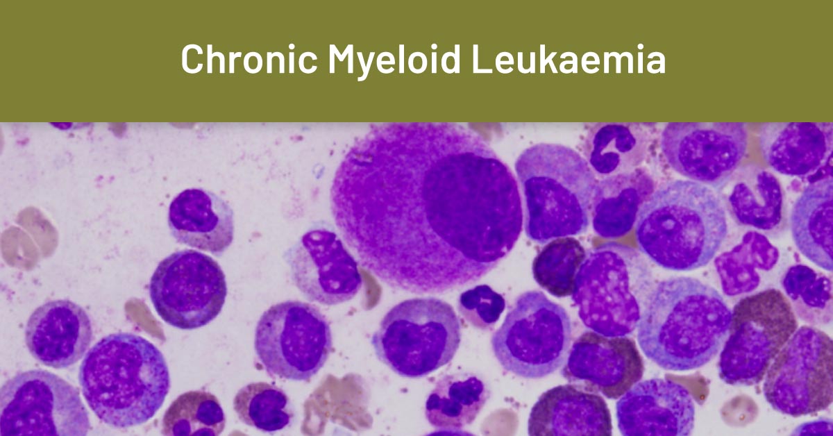 Dr. Hari Menon talks about Chronic myeloid leukemia
