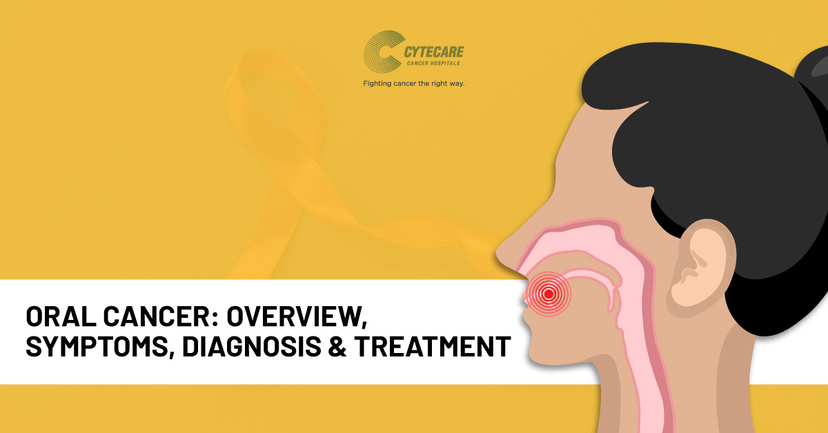Mouth Cancer: Overview, Symptoms, Diagnosis & Treatment