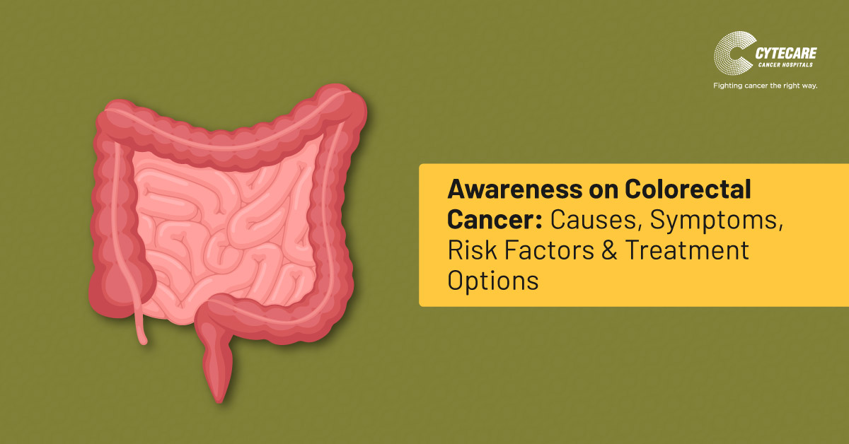 Colon Cancer: Causes, Symptoms, Risk Factors & Treatment Options