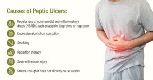 Causes of Peptic Ulcers