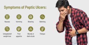 Symptoms of Peptic Ulcers